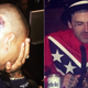 Illustration for article titled Who Wore It Worst: Chris Browns Head Tattoo vs. Yelawolfs Confederate Flag Jacket
